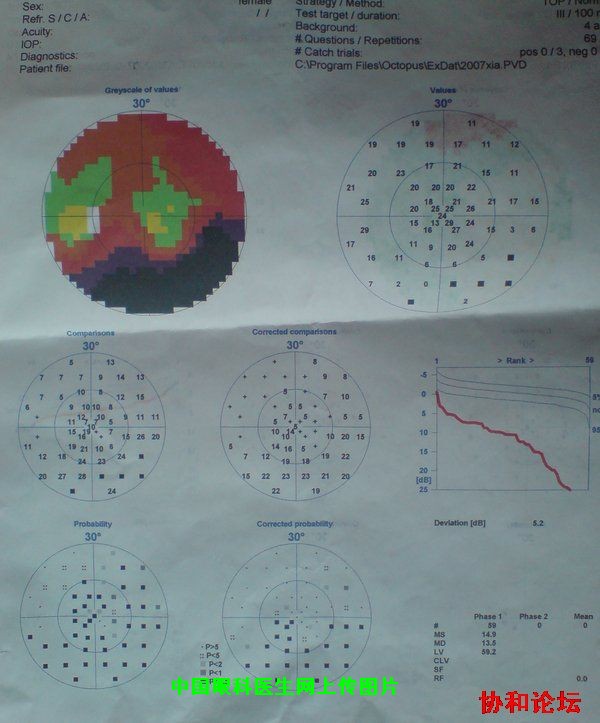 dvubb 图片点击可在新窗口打开查看